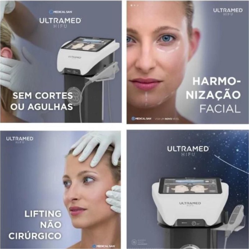 Lifting não cirúrgico